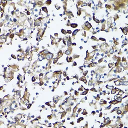 Anti-GARS antibody used in IHC (Paraffin sections) (IHC-P). GTX54147