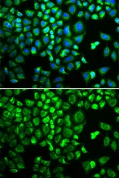 Anti-HAX1 antibody used in Immunocytochemistry/ Immunofluorescence (ICC/IF). GTX54149