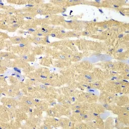 Anti-HAX1 antibody used in IHC (Paraffin sections) (IHC-P). GTX54149