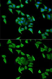 Anti-Hemopexin antibody used in Immunocytochemistry/ Immunofluorescence (ICC/IF). GTX54150
