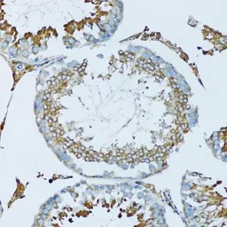 Anti-Hemopexin antibody used in IHC (Paraffin sections) (IHC-P). GTX54150