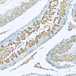Anti-Hemopexin antibody used in IHC (Paraffin sections) (IHC-P). GTX54150