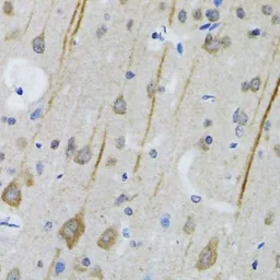 Anti-5-HT3A receptor antibody used in IHC (Paraffin sections) (IHC-P). GTX54151