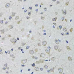 Anti-5-HT3A receptor antibody used in IHC (Paraffin sections) (IHC-P). GTX54151