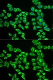 Anti-HADHB antibody used in Immunocytochemistry/ Immunofluorescence (ICC/IF). GTX54152