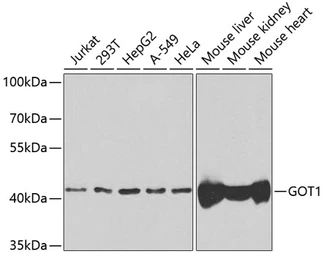 Anti-GOT1 antibody used in Western Blot (WB). GTX54155