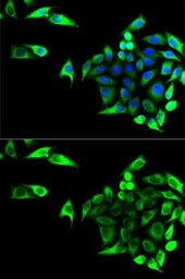 Anti-GOT1 antibody used in Immunocytochemistry/ Immunofluorescence (ICC/IF). GTX54155