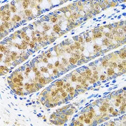 Anti-GOT1 antibody used in IHC (Paraffin sections) (IHC-P). GTX54155