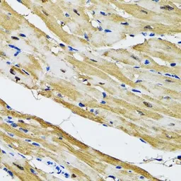Anti-GOT1 antibody used in IHC (Paraffin sections) (IHC-P). GTX54155