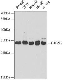 Anti-GTF2F2 antibody used in Western Blot (WB). GTX54156