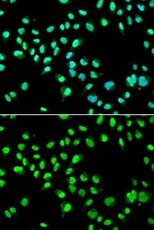 Anti-GTF2F2 antibody used in Immunocytochemistry/ Immunofluorescence (ICC/IF). GTX54156