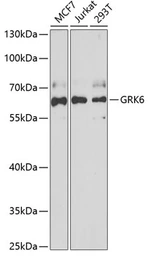 Anti-GRK6 antibody used in Western Blot (WB). GTX54160