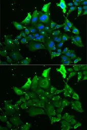 Anti-GRK6 antibody used in Immunocytochemistry/ Immunofluorescence (ICC/IF). GTX54160