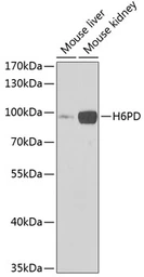 Anti-H6PD antibody used in Western Blot (WB). GTX54162