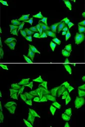 Anti-H6PD antibody used in Immunocytochemistry/ Immunofluorescence (ICC/IF). GTX54162
