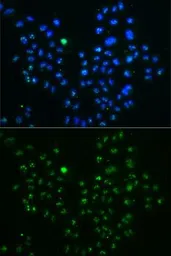 Anti-Nucleostemin antibody used in Immunocytochemistry/ Immunofluorescence (ICC/IF). GTX54163