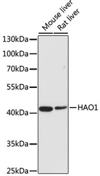 Anti-HAO1 antibody used in Western Blot (WB). GTX54164