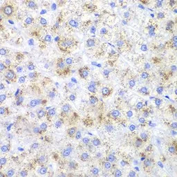 Anti-HAO1 antibody used in IHC (Paraffin sections) (IHC-P). GTX54164