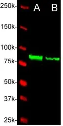 Anti-Ctnnb1 antibody used in Western Blot (WB). GTX54176