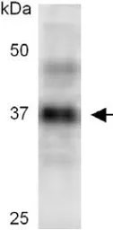 Anti-Casp3b antibody used in Western Blot (WB). GTX54181