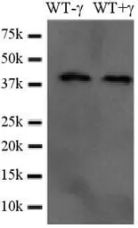 Anti-Casp3b antibody used in Western Blot (WB). GTX54181