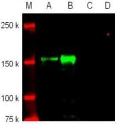Anti-Rock1 antibody used in Western Blot (WB). GTX54189
