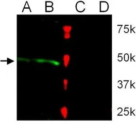Anti-Tal1 antibody used in Western Blot (WB). GTX54215
