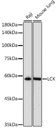 Anti-Lck antibody used in Western Blot (WB). GTX54287