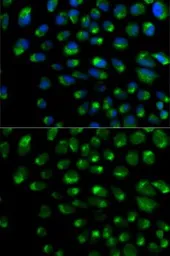 Anti-IFNAR2 antibody used in Immunocytochemistry/ Immunofluorescence (ICC/IF). GTX54289