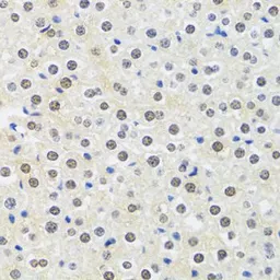 Anti-MTAP antibody used in IHC (Paraffin sections) (IHC-P). GTX54291