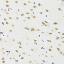 Anti-MTAP antibody used in IHC (Paraffin sections) (IHC-P). GTX54291