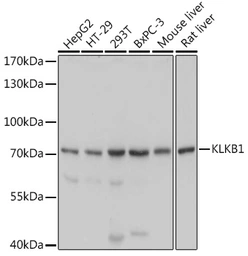 Anti-Plasma Kallikrein 1B antibody used in Western Blot (WB). GTX54292
