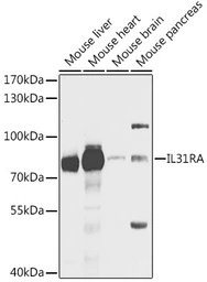 Anti-IL31RA antibody used in Western Blot (WB). GTX54294