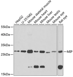 Anti-Aquaporin 0 antibody used in Western Blot (WB). GTX54297