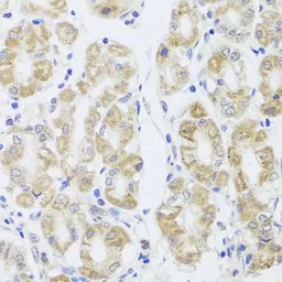 Anti-Aquaporin 0 antibody used in IHC (Paraffin sections) (IHC-P). GTX54297