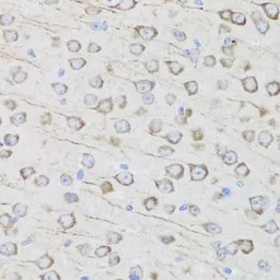Anti-Aquaporin 0 antibody used in IHC (Paraffin sections) (IHC-P). GTX54297