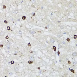 Anti-Aquaporin 0 antibody used in IHC (Paraffin sections) (IHC-P). GTX54297