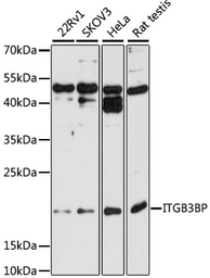Anti-ITGB3BP antibody used in Western Blot (WB). GTX54299
