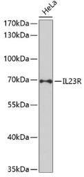 Anti-IL23 Receptor antibody used in Western Blot (WB). GTX54301