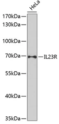 Anti-IL23 Receptor antibody used in Western Blot (WB). GTX54301
