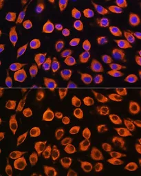 Anti-IL23 Receptor antibody used in Immunocytochemistry/ Immunofluorescence (ICC/IF). GTX54301