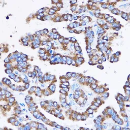 Anti-IL23 Receptor antibody used in IHC (Paraffin sections) (IHC-P). GTX54301