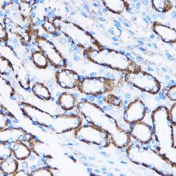 Anti-IL23 Receptor antibody used in IHC (Paraffin sections) (IHC-P). GTX54301