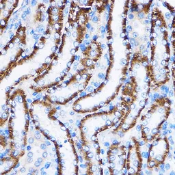 Anti-IL23 Receptor antibody used in IHC (Paraffin sections) (IHC-P). GTX54301