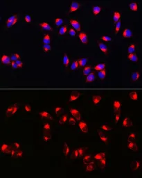 Anti-Melan A antibody used in Immunocytochemistry/ Immunofluorescence (ICC/IF). GTX54303