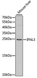 Anti-IL28B antibody used in Western Blot (WB). GTX54305