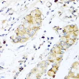 Anti-IL28B antibody used in IHC (Paraffin sections) (IHC-P). GTX54305