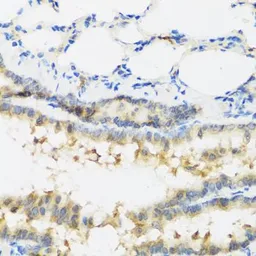 Anti-IL28B antibody used in IHC (Paraffin sections) (IHC-P). GTX54305