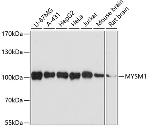 Anti-MYSM1 antibody used in Western Blot (WB). GTX54308