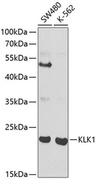 Anti-Kallikrein 1 antibody used in Western Blot (WB). GTX54309